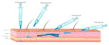 Subbutenous Injection 2