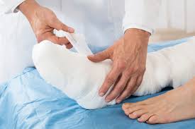 Wound Management -6
